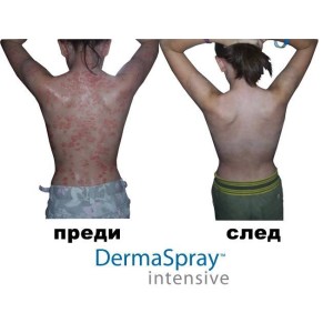 ДермаСпрей Интензив (DermaSpray Intensive) | Salcura