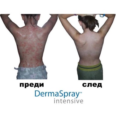 ДермаСпрей Интензив (DermaSpray Intensive) | Salcura