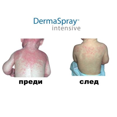 ДермаСпрей Интензив (DermaSpray Intensive) | Salcura