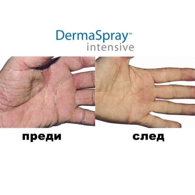 ДермаСпрей Интензив (DermaSpray Intensive) | Salcura