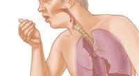 Бронхитът – симптоми, лечение и превенция