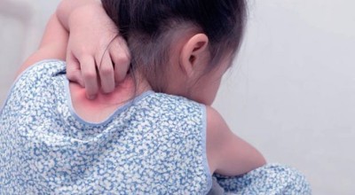 Ако Вие сте родител на дете с псориазис – това е за Вас!