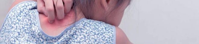 Ако Вие сте родител на дете с псориазис – това е за Вас!