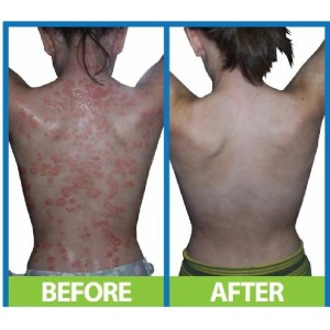 ДермаСпрей Интензив (DermaSpray Intensive) 250 мл | Salcura