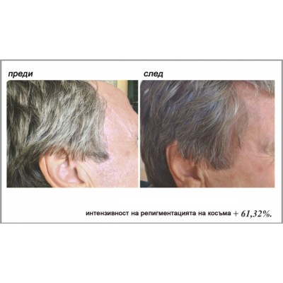 Stop Gray Hair Препятства побеляването на косата Не боядисва косъма, а възвръща естествения му цвят За всеки тип коса С добавен ензим каталаза Лесна и бърза употреба Ефективен резултат Stop Gra Stop Gray Hair Препятства побеляването на косата Не боядисва 