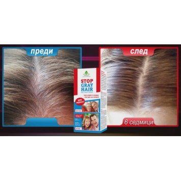 Stop Gray Hair Препятства побеляването на косата Не боядисва косъма, а възвръща естествения му цвят За всеки тип коса С добавен ензим каталаза Лесна и бърза употреба Ефективен резултат Stop Gra Stop Gray Hair Препятства побеляването на косата Не боядисва 