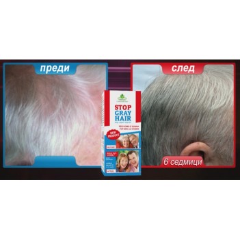 Stop Gray Hair Препятства побеляването на косата Не боядисва косъма, а възвръща естествения му цвят За всеки тип коса С добавен ензим каталаза Лесна и бърза употреба Ефективен резултат Stop Gra Stop Gray Hair Препятства побеляването на косата Не боядисва 