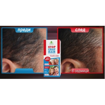 Stop Gray Hair Препятства побеляването на косата Не боядисва косъма, а възвръща естествения му цвят За всеки тип коса С добавен ензим каталаза Лесна и бърза употреба Ефективен резултат Stop Gra Stop Gray Hair Препятства побеляването на косата Не боядисва 