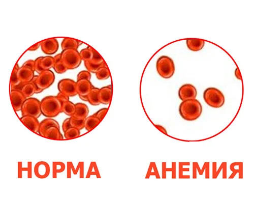 Семената от моринга помагат срещу анемия, подагра, бактериални инфекции