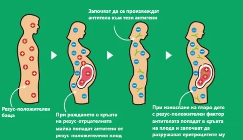 От резус-фактора на майката зависи нормалното развитие на плода по време на бременност