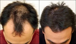 Biotin от 21st Century се грижи за Вашата коса, предпазва от косопад.