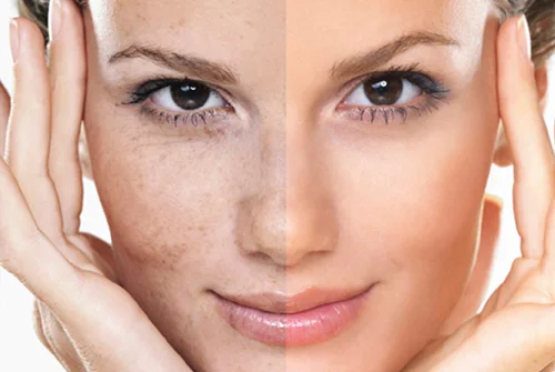 Kalivi Repair Face Serum 30 мл на отлична цена от Amrita Laboratory постепенно намалява петната по кожата и подобрява нейното състояние