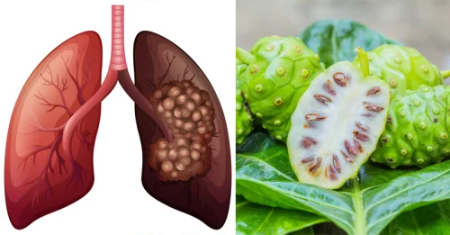 Bio Noni Juice на изгодна цена предпазва от рак на белите дробове, бъбреците и черния дроб