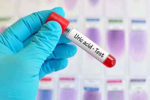 CholesteLow 30 капсули за Висок Холестерол на добра цена от Different Pharm поддържа по-ниски нива на пикочната киселина