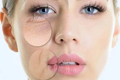 Collagen Types 1 and 3 Powder 200 gr от Doctor`s Best на топ цена подобрява еластичността на кожата и предпазва от появата на бръчки