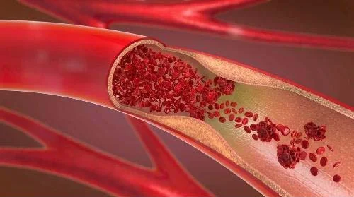 Pycnogenol (Пикногенол) 100 мг 60 веге капсули на чудесна цена от Healthy Origins поддържа здравословно кръвообрашение
