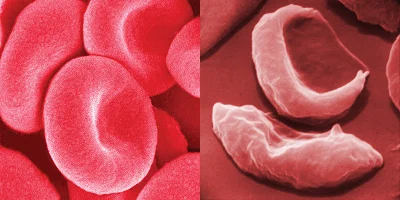 Methyl Folate на топ цена подобрява кръвообразуването и предпазва от анемия