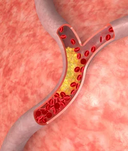 omega-3-6-9-complex на изумителна цена премахва холестеролната плака и подпомага кръвоносната система