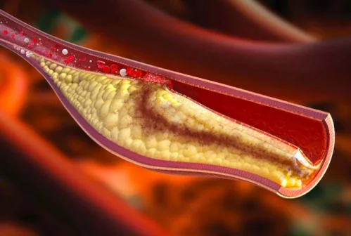 Advanced Cholesterol Formula от Natural Factors намалява холестерола и подобрява метаболизма