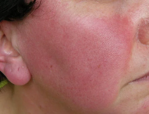 Ниацин Инозитол Хексаникотинат от Natural Factors не предизвиква зачервяване