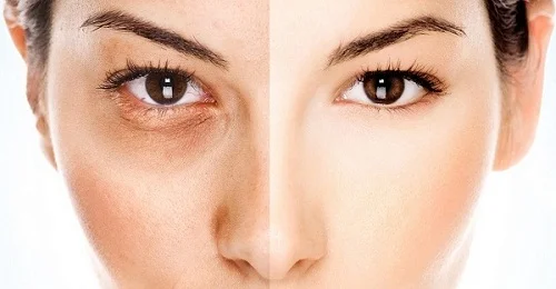 Collagen Concentrate на Prozis Foods се бори с бръчките и подобрява състоянието на кожата
