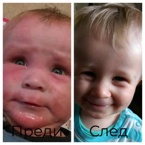 Bioskin Junior Shampoo на Salcura на добра цена почиства нежно скалпа и косата.