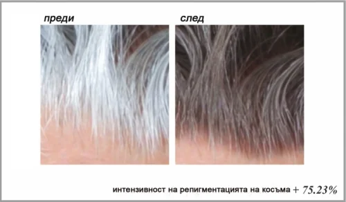 Stop Gray Hair е нов революционен метод за справяне с побеляването.