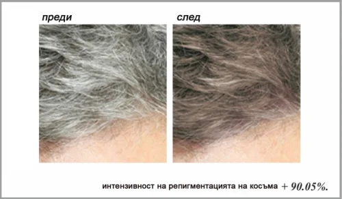  Stop Gray Hair на страхотна цена видимо възвръща цвета и жизнеността на косата.