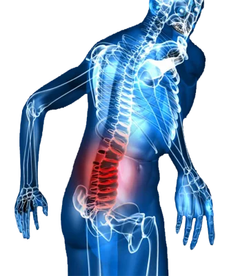 Osteo Back Pain Relief with InflamEase на супер цена намалява болките в гърба и кръста