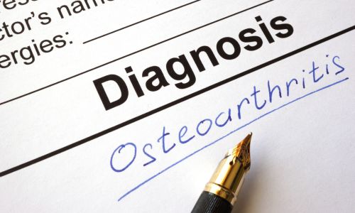 Диагностика на остеоартрит