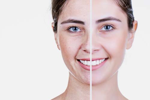 NMN (Nicotinamide mononucleotide) 60 веган капсули с топ цена от Different Pharm забавя стареенето на клетките