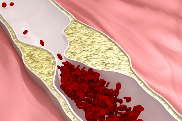 Heart - Cholesterol Support / Phytosterols от HAYA LABS понижава нивото на холестерол в кръвта, помага против стенокардия и атеросклероза.