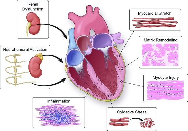 Chelohart Heart Peptide на топ цена е добавка, която нормализира функцията на сърцето.